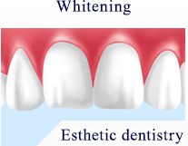 Whitening Esthetic dentistry