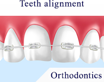 Teeth alignment Orthodontics