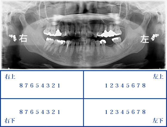 歯の数え方（患者さん用）